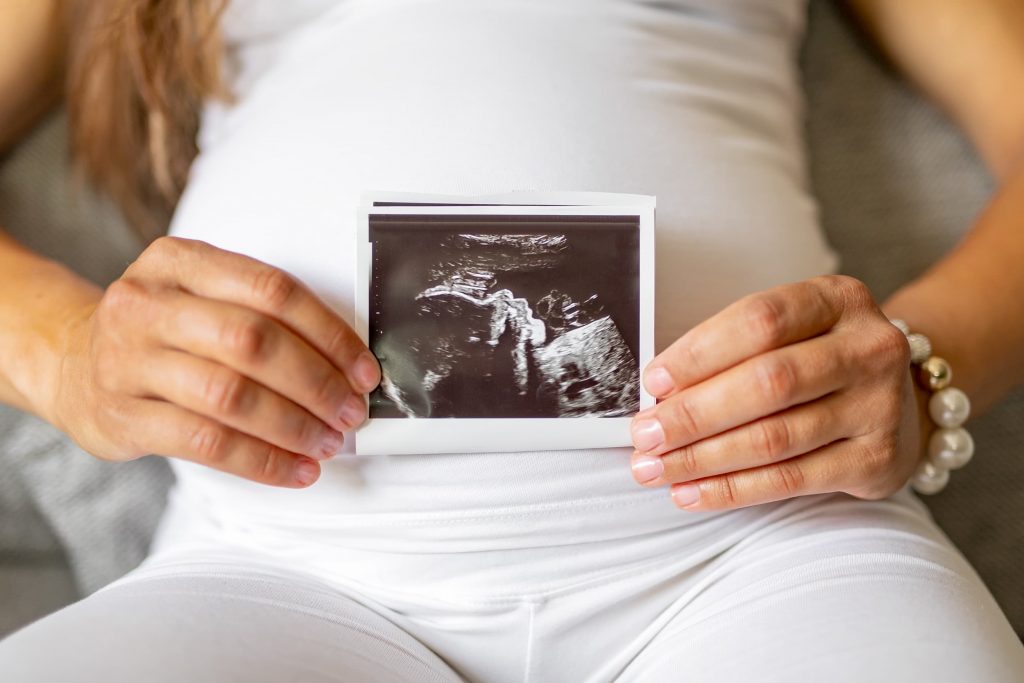 Pregnant woman holding her scan